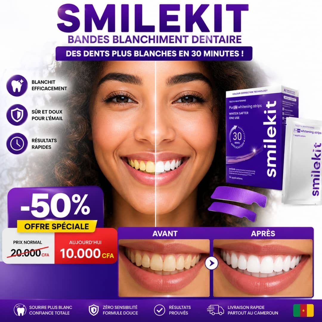 SmileKit™️ – Bandes Blanchissantes Dentaires Professionnelles | Sourire Blanc en 30 Minutes ✨