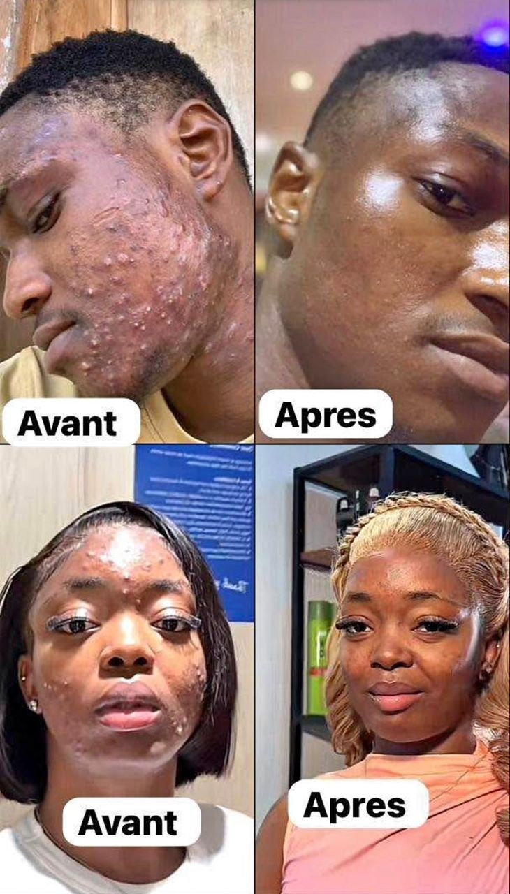 ✨ Votre peau mérite mieux que du maquillage qui cache. Elle mérite un sérum qui guérit.